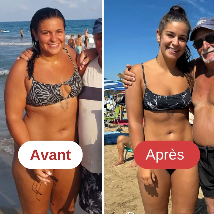 Avant après xperfsante 1