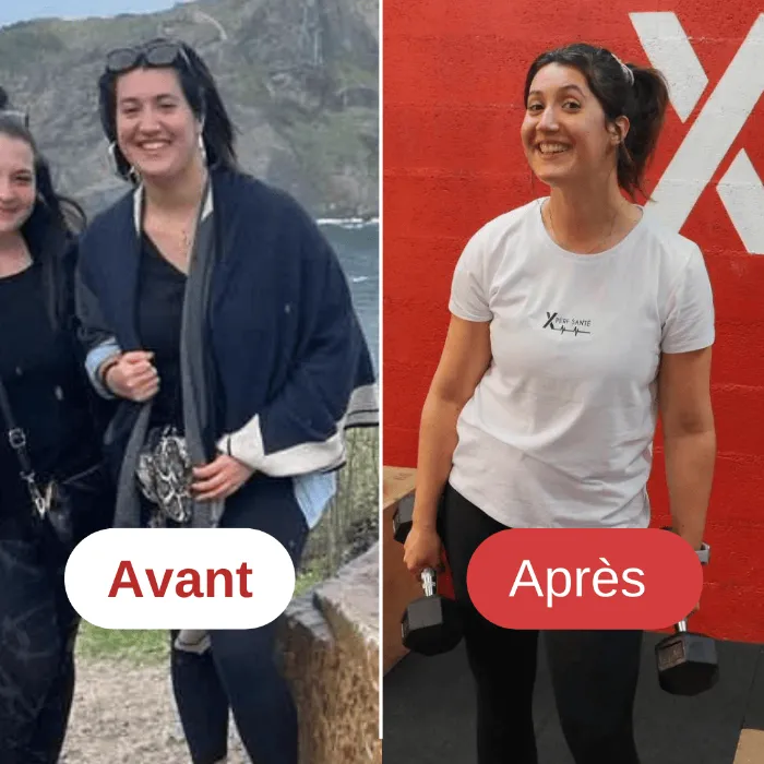 Avant après xperfsante 14